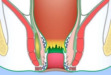 Ano-rectal